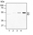 ACCase subunit beta | Acetyl-coenzyme A, carboxylase (subunit beta)